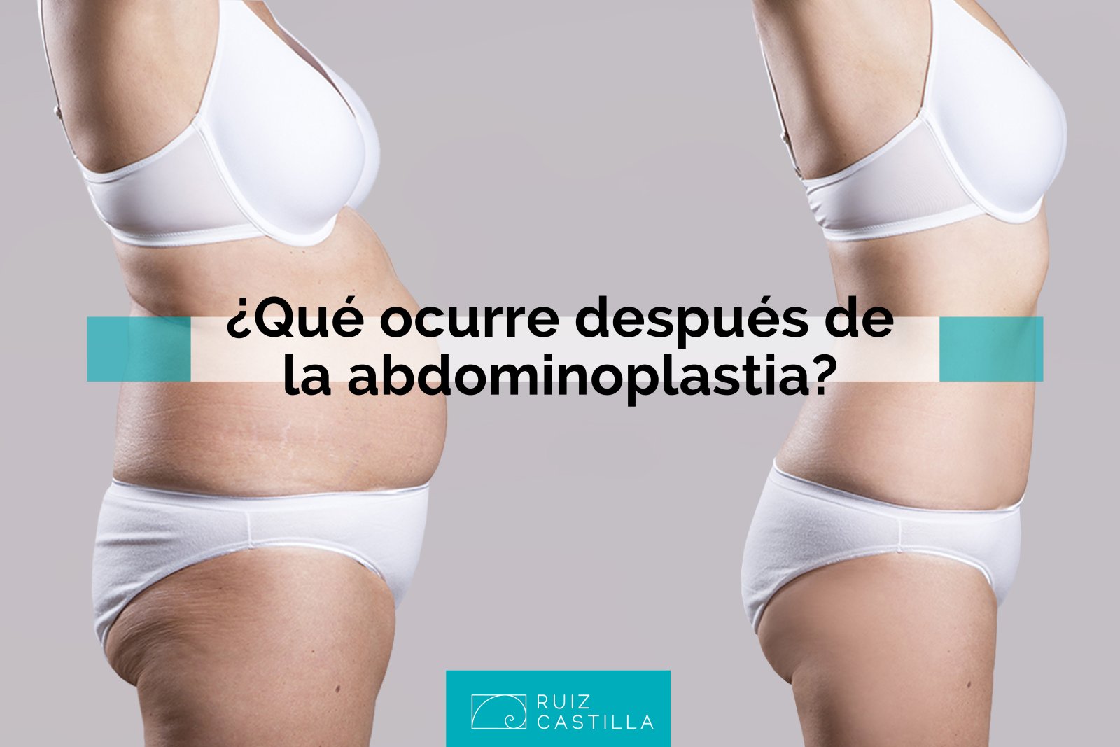 Qué es una abdominoplastia y cómo se realiza? - Clínica Uribe